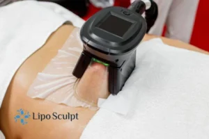 Are The Results From Aqualyx Permanent? 4 Compare Aqualyx Belper to other fat reduction treatments.