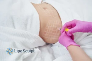 Are The Results From Aqualyx Permanent? 1 Do you want to know how long Aqualyx Belper results last?