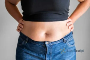 Bidding Farewell to Muffin Tops with Aqualyx Fat Injections 2 Do you wish you could reduce your muffin top Belper With Aqualy fat dissolving injections you can!